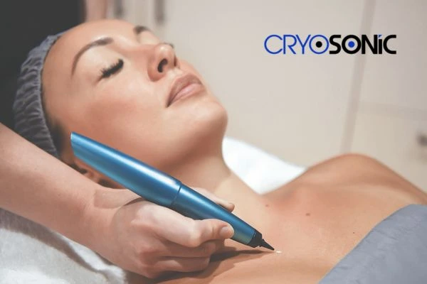 Cryosonic lesion removal prices book today! Leighton Buzzard