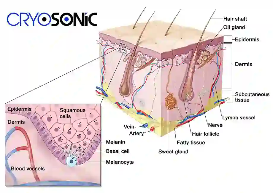 How Cryotherapy Stimulates Melanocyte Activity  Leighton Buzzard